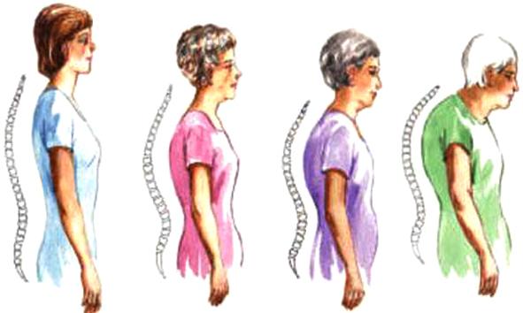 腰疼吃什么钙片补钙效果好（腰痛补钙）-硒宝网