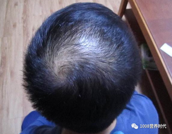 人体所需微量元素(人体微量元素需求标准)-硒宝网