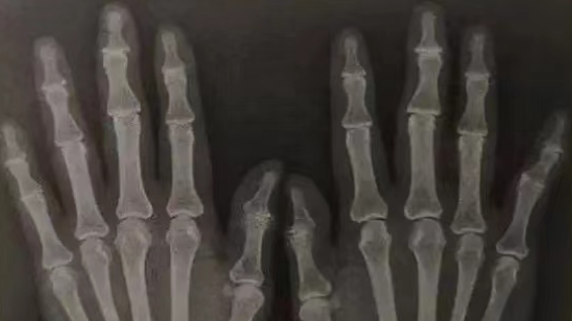 为什么选择富硒产品呢（富硒产品选择什么品牌）-硒宝网