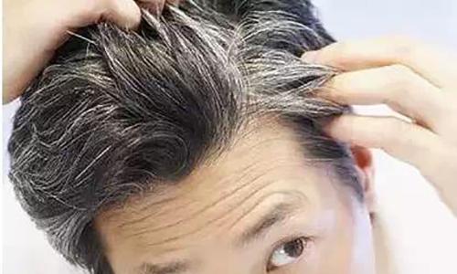孩子有白头发是缺少什么微量元素(微量元素缺乏引起白头发)-硒宝网