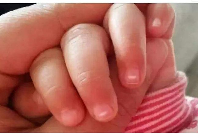 磨牙缺少什么微量元素(缺少微量元素磨牙会出血吗)-硒宝网