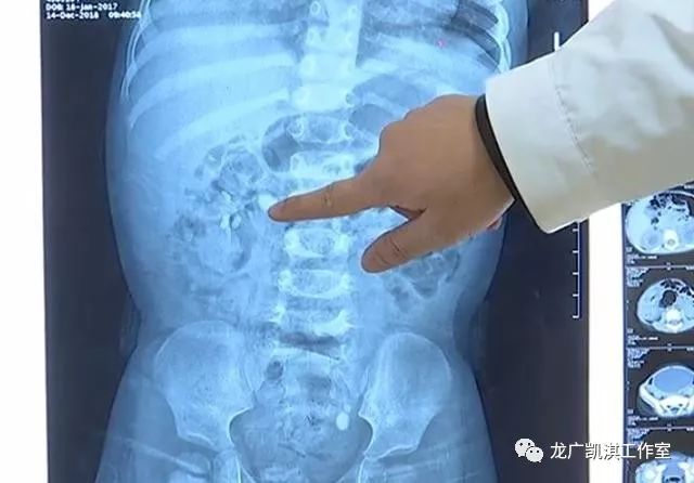 六岁儿童补钙吃什么钙片好(儿童吃钙片到底吃什么)-硒宝网