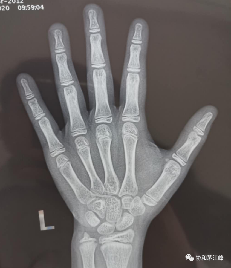 医院查微量元素挂什么科（微量元素检查科室）-硒宝网