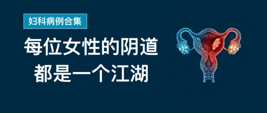 孕妇补铁(孕妇补铁吃哪种铁剂)-硒宝网
