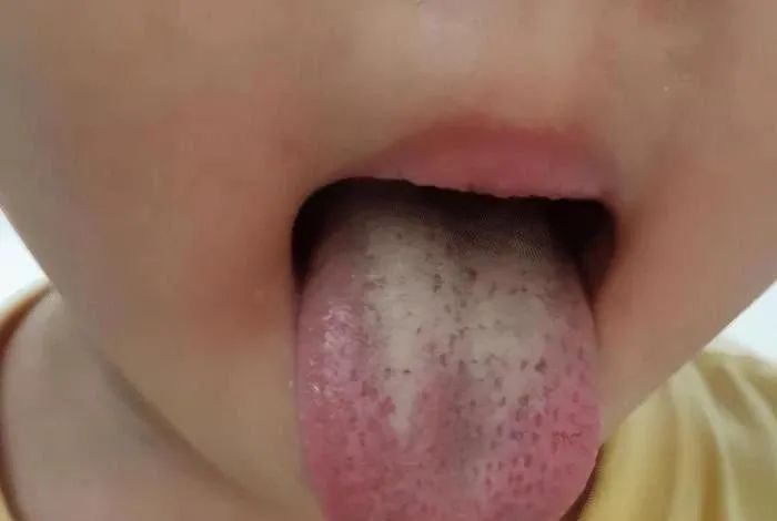 儿童吃什么补锌效果最好(儿童吃补锌有什么好处)-硒宝网