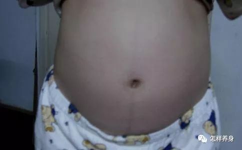 肝癌喝富硒茶好吗女性(硒对肝癌)-硒宝网