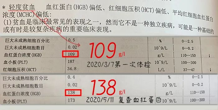 儿童补铁哪个牌子好(牌子儿童好补铁的有哪些)-硒宝网