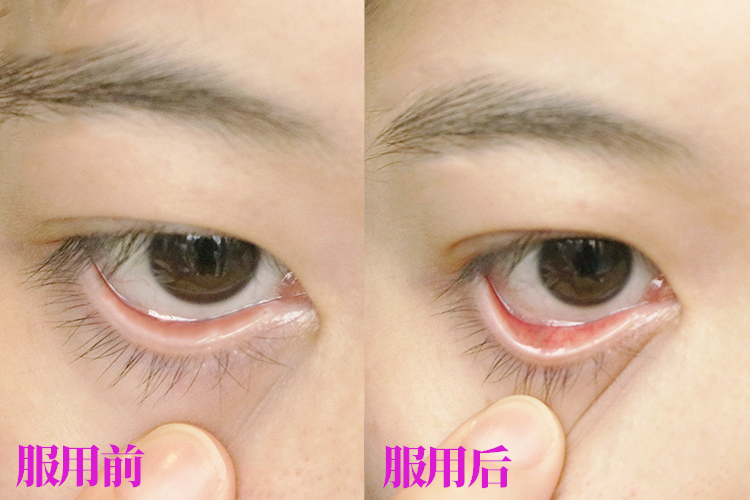 儿童补铁哪个牌子好(牌子儿童好补铁的有哪些)-硒宝网