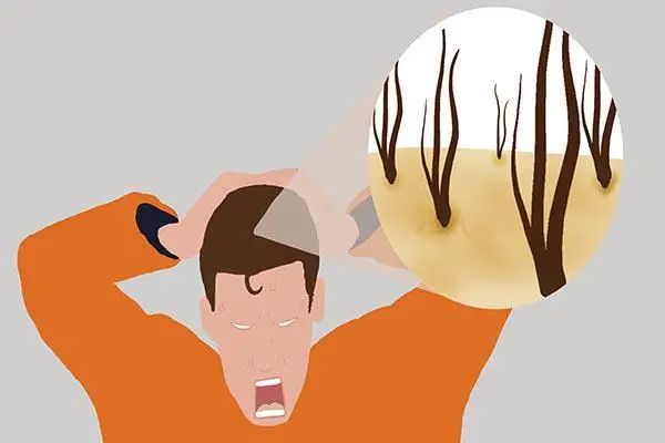 男人缺钙吃什么补钙好(男人补钙)-硒宝网