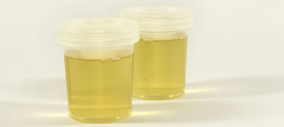 查微量元素需要多久出结果（查微量元素结果出需要空腹吗）-硒宝网