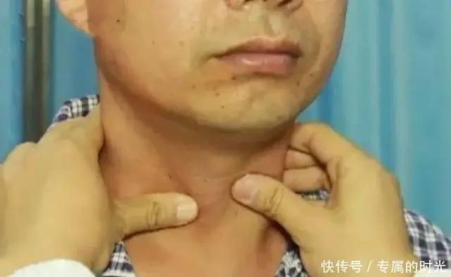 甲状腺癌能喝富硒茶嘛(甲状腺癌茶能不能喝)-硒宝网