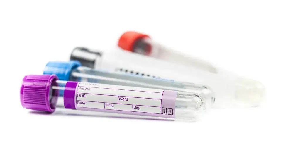 微量元素是抽血检查吗(微量元素抽血检查是查什么)-硒宝网