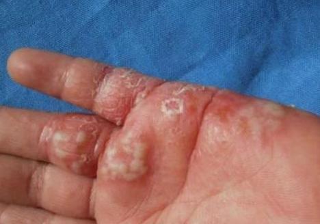 糖尿病能喝紫阳富硒茶(糖尿病患者可以喝富硒康吗)-硒宝网