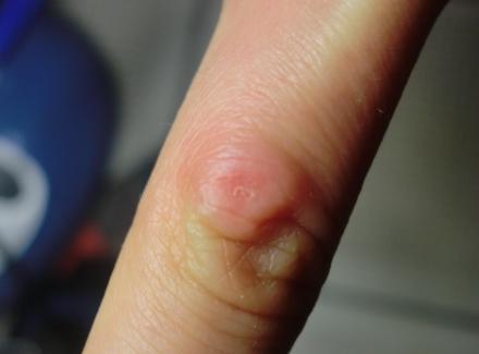 糖尿病能喝紫阳富硒茶(糖尿病患者可以喝富硒康吗)-硒宝网