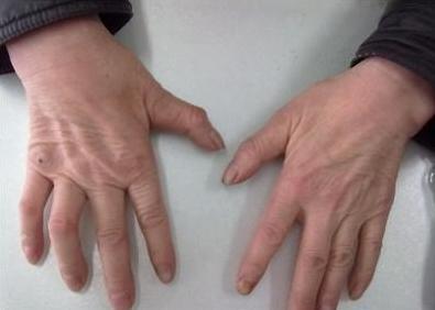 糖尿病能喝紫阳富硒茶(糖尿病患者可以喝富硒康吗)-硒宝网