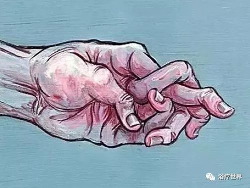 腱鞘炎缺什么微量元素(腱鞘炎是缺什么维生素)-硒宝网