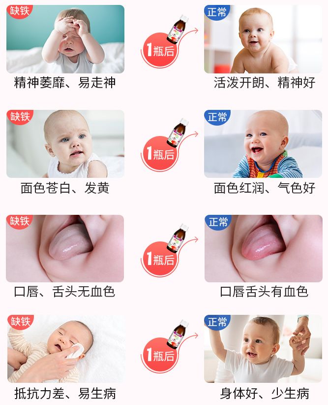婴幼儿补锌哪个牌子好（婴儿补锌最好的品牌）-硒宝网