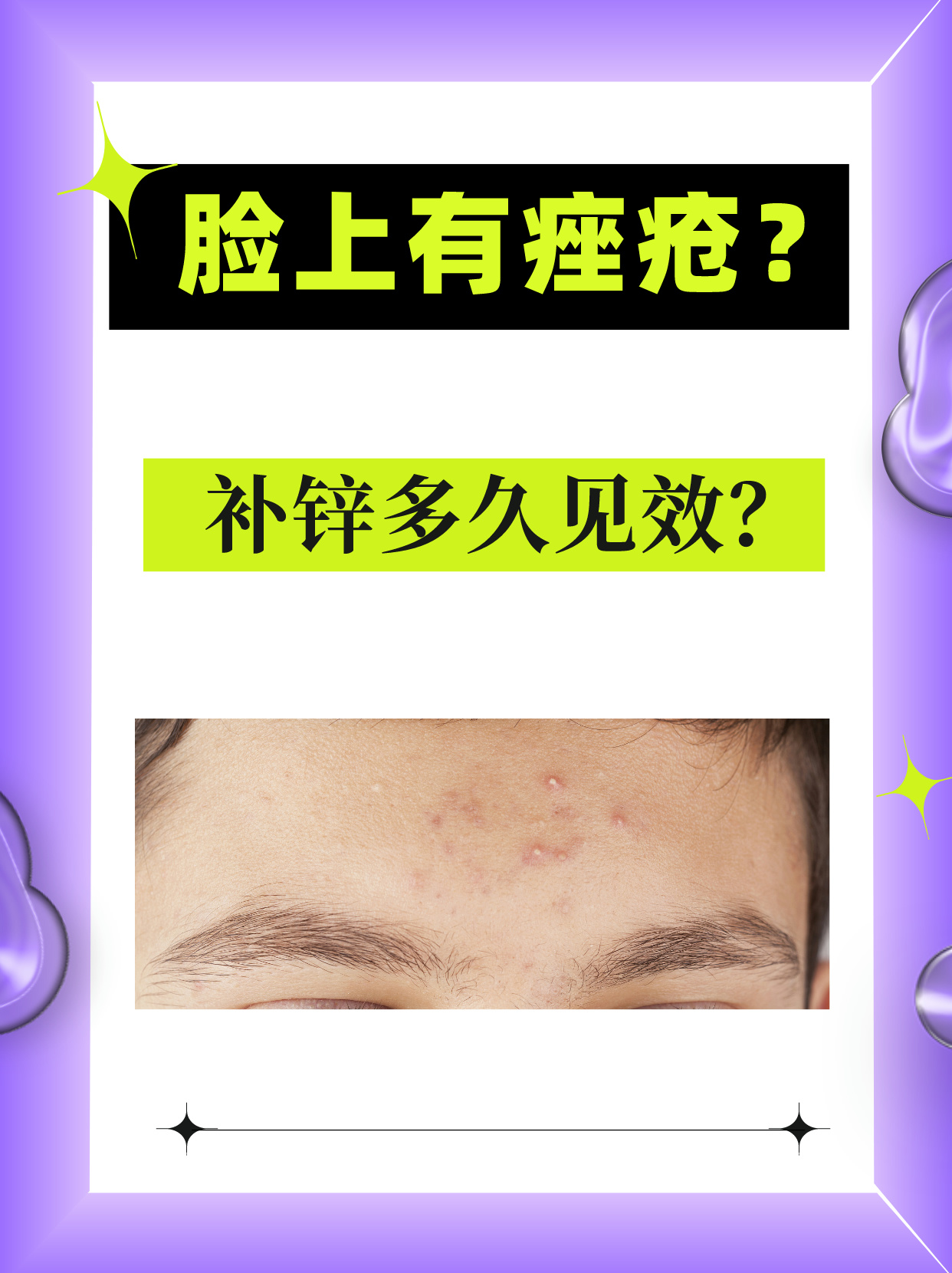 补锌有什么好处(补锌的有什么)-硒宝网