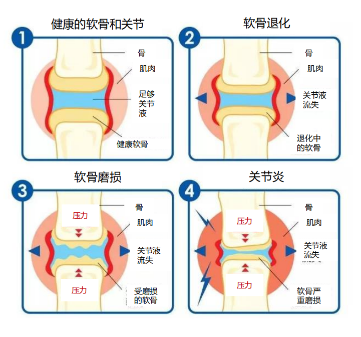 年轻人补钙吃什么牌子钙片好（钙片年轻人吃哪种）-硒宝网