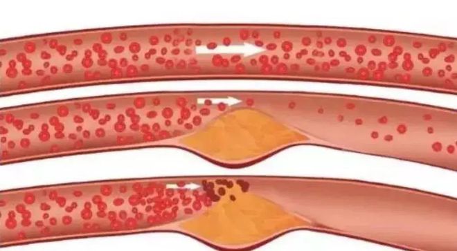 富硒大米煮稀饭煮多久(煮大米稀饭富硒能吃吗)-硒宝网