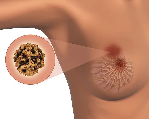 富硒大米发霉了能吃吗（发霉的大米吃了会得肺癌吗）-硒宝网