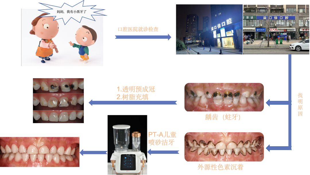 补铁牙齿变黑了怎么办（补铁黑牙怎么办）-硒宝网