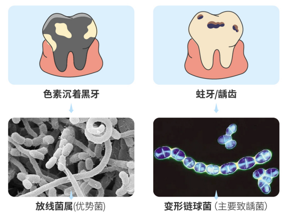 补铁牙齿变黑了怎么办（补铁黑牙怎么办）-硒宝网