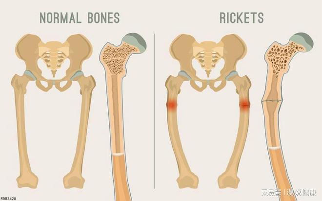 吃什么补钙快(补钙吃什么最快)-硒宝网
