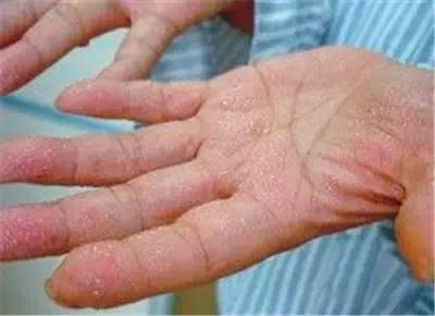 中年女人补钙吃什么牌子的钙片好（中年女性补钙产品）-硒宝网