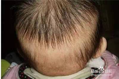 中年女人补钙吃什么牌子的钙片好（中年女性补钙产品）-硒宝网