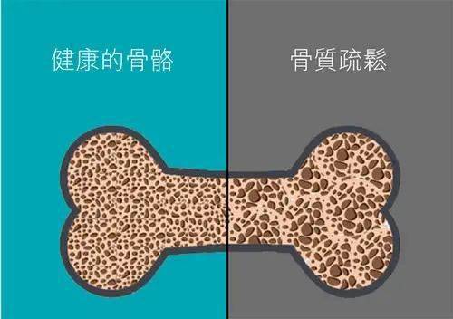 吃什么东西补钙最好(补钙东西吃好还是不吃)-硒宝网