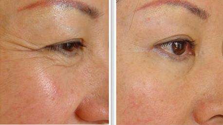 哪些水果蔬菜含富硒肽(蔬菜水果肽含富硒吗)-硒宝网