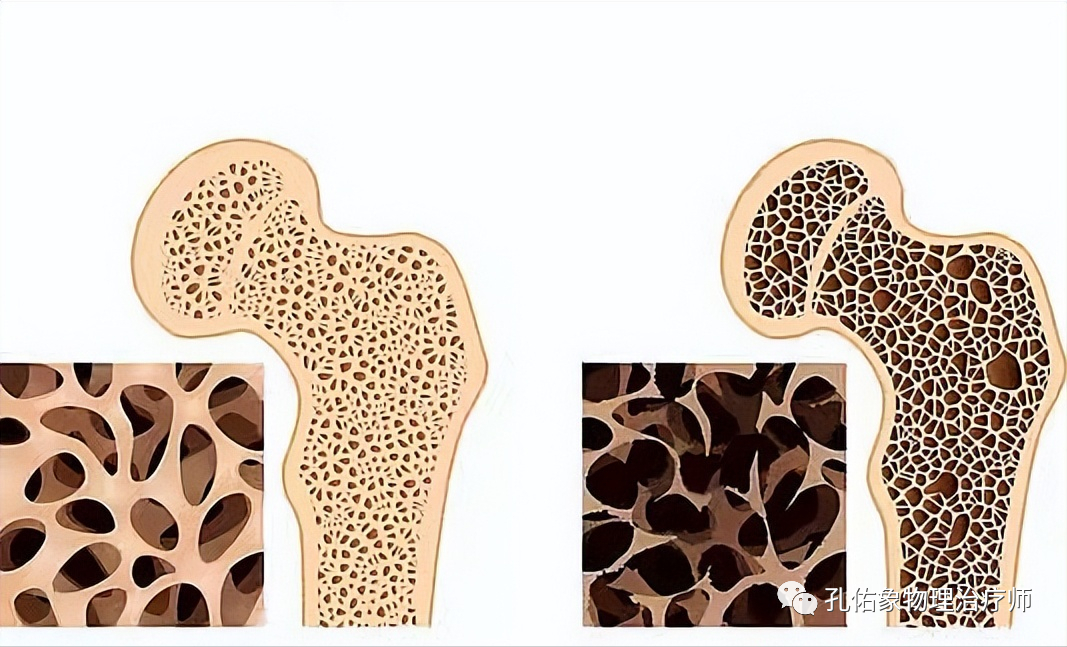 50岁补钙吃什么钙片好(补钙吃钙片好还是口服液好)-硒宝网