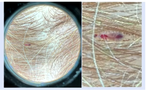 服用硒产品对皮肤瘙痒（服用瘙痒皮肤产品硒片有用吗）-硒宝网