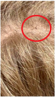 服用硒产品对皮肤瘙痒（服用瘙痒皮肤产品硒片有用吗）-硒宝网