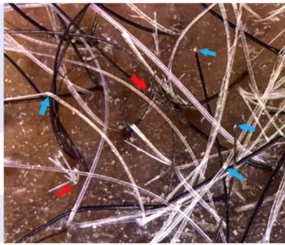 服用硒产品对皮肤瘙痒（服用瘙痒皮肤产品硒片有用吗）-硒宝网