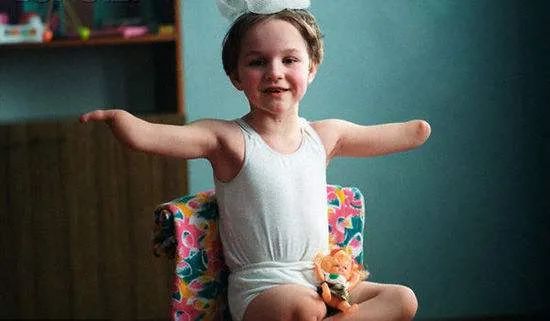 桥本甲状腺吃含硒产品(桥本甲状腺炎吃硒)-硒宝网