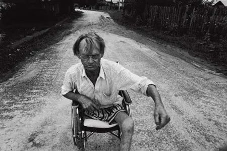 桥本甲状腺吃含硒产品(桥本甲状腺炎吃硒)-硒宝网