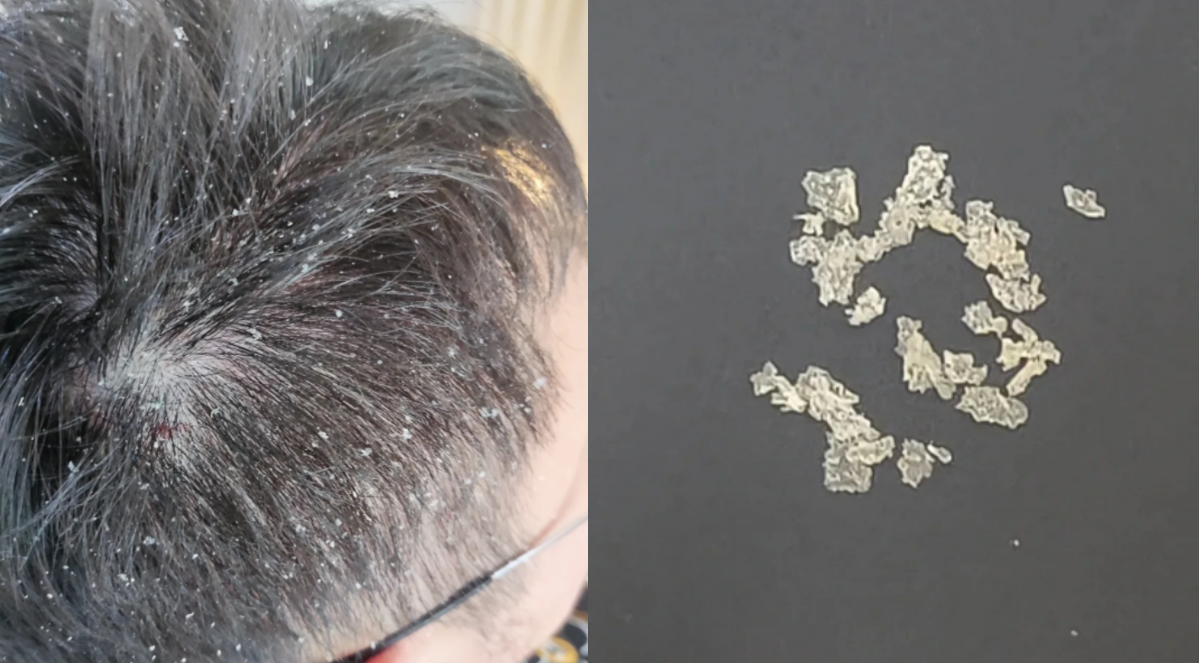 怎样购买二硫化硒产品(硫化硒有毒吗)-硒宝网