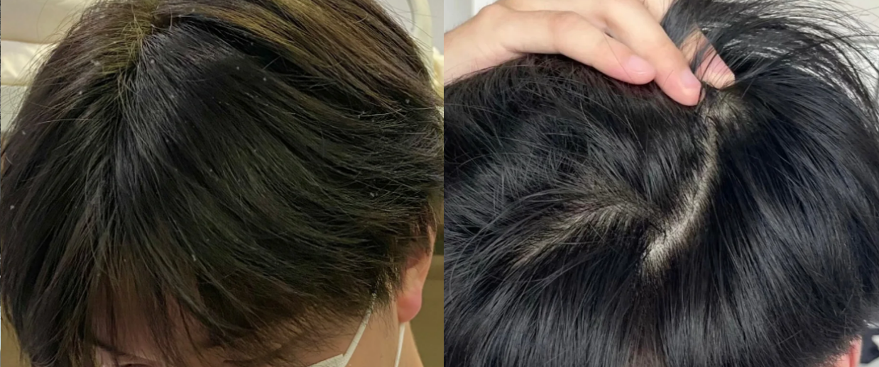 怎样购买二硫化硒产品(硫化硒有毒吗)-硒宝网