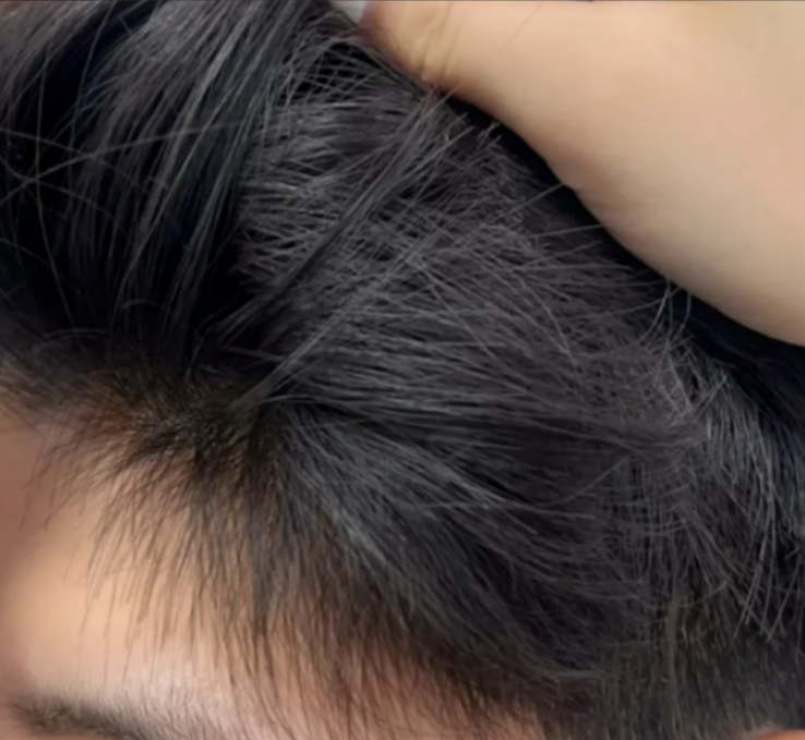 怎样购买二硫化硒产品(硫化硒有毒吗)-硒宝网