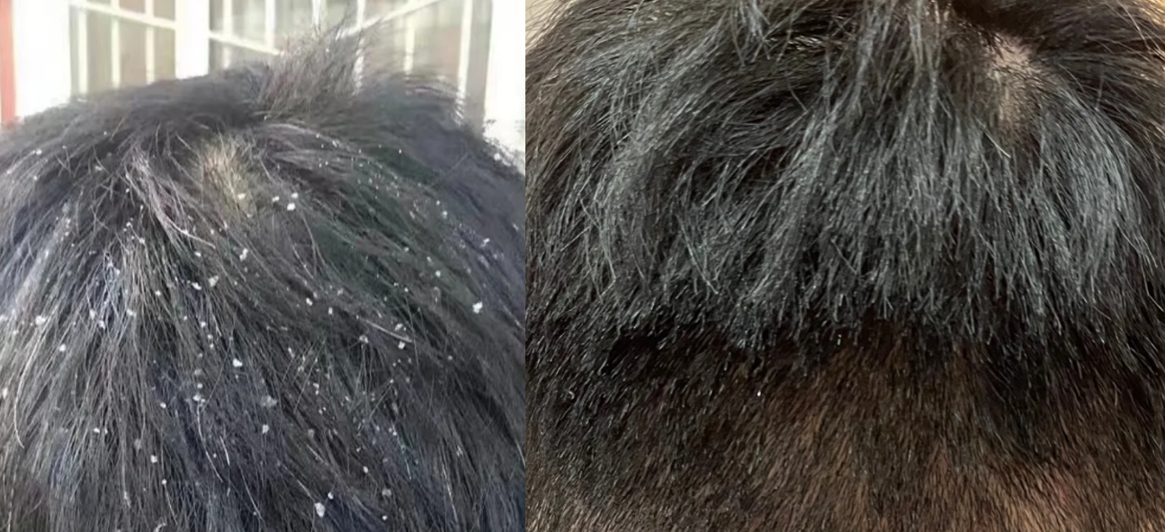 怎样购买二硫化硒产品(硫化硒有毒吗)-硒宝网