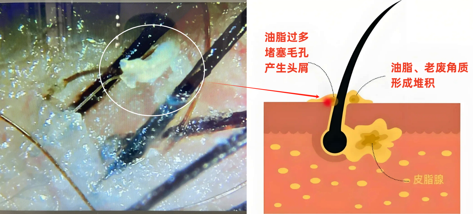 怎样购买二硫化硒产品(硫化硒有毒吗)-硒宝网