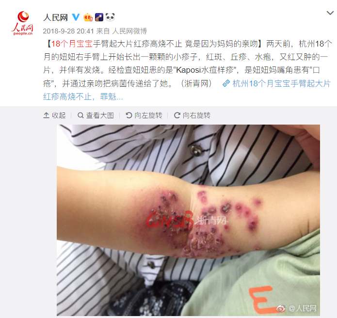 有哪些成人补锌硒产品(成人锌硒片)-硒宝网
