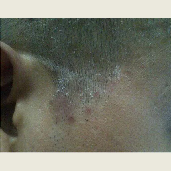 硒的产品有哪些品牌呢（硒的产品有哪些）-硒宝网