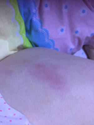 服用硒产品对皮肤骚痒（坐月子全身痒皮肤干痒）-硒宝网