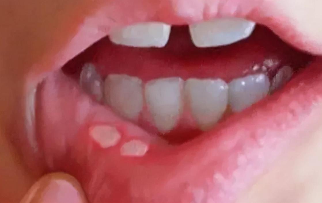 女人缺微量元素的表现(女人缺微量元素会失眠吗)-硒宝网