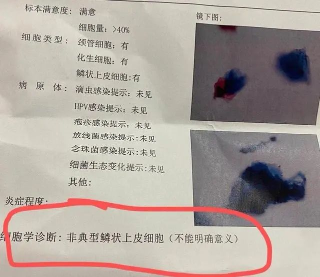 硒维康对HPV有用吗(硒维康能使hpv转阴吗)-硒宝网