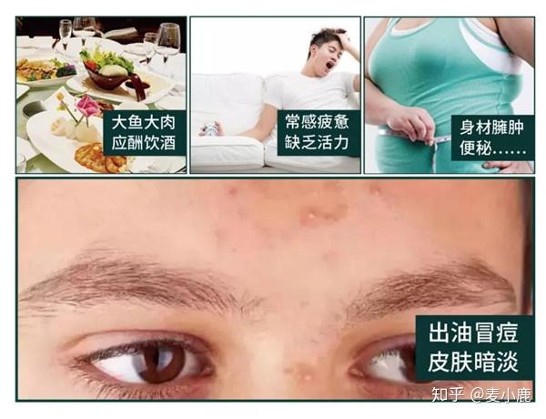 硒维康副作用胸前长痘(硒痘痘)-硒宝网