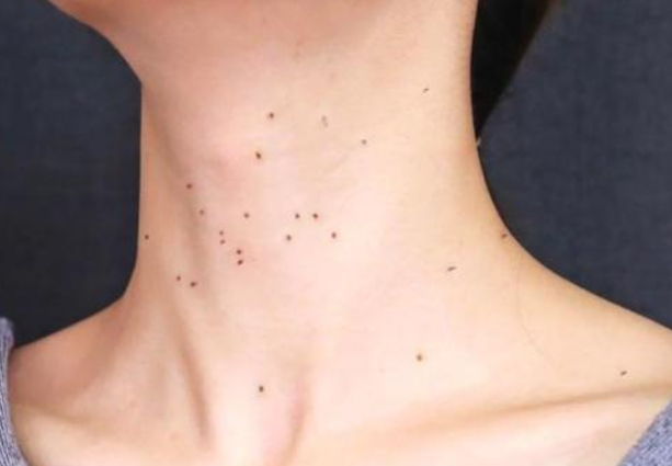 硒维康能不能长期服用（能服用长期硒维康片吗）-硒宝网